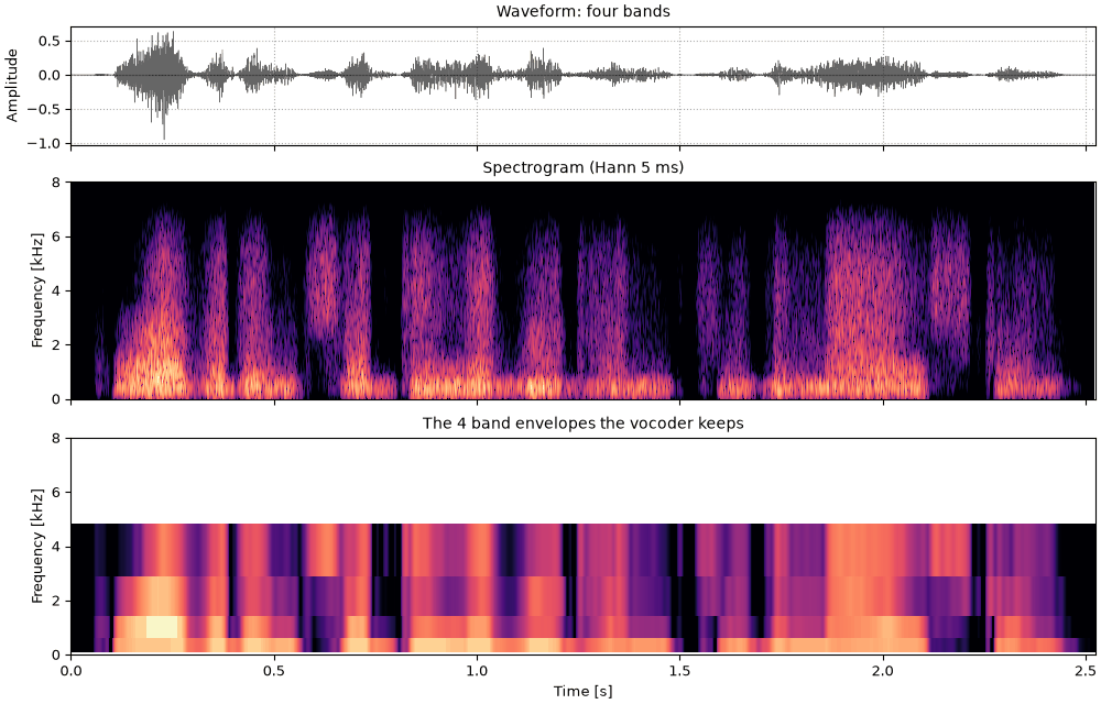 Plots of the four bands sound