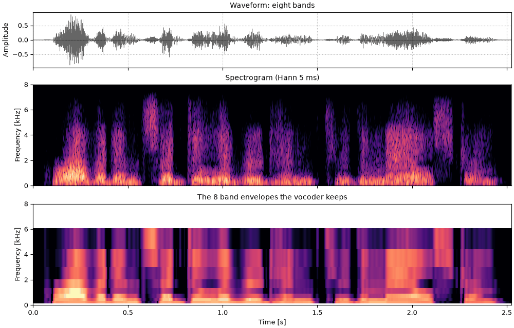 Plots of the eight bands sound