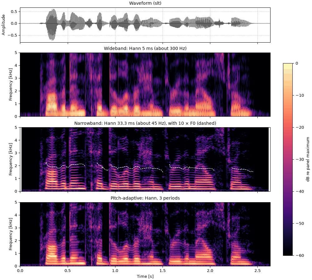 Plots of the the same sentence, a higher voice sound
