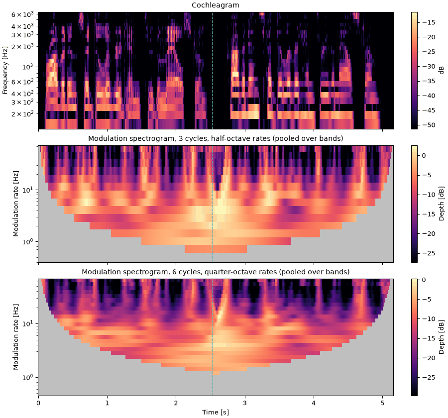 Plots of the the same sentence, two voices sound